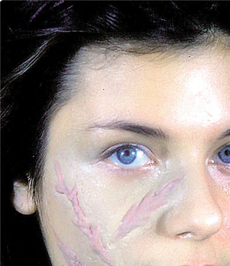 Woochie Scar Set 3 Prosthetics Makeup Kit