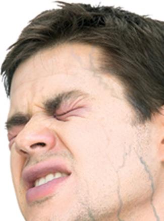 Vampire Bites Prosthetic Makeup Accessory